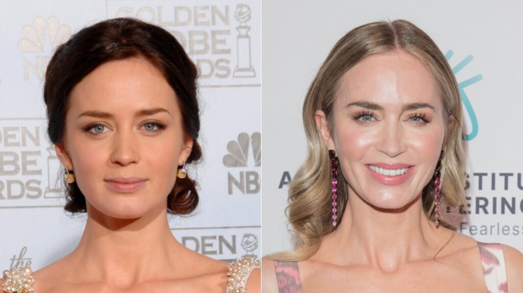 emily blunt plastic surgery emily blunt plastic surgery